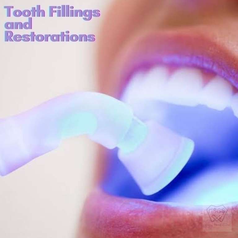 tooth fillings and restorations