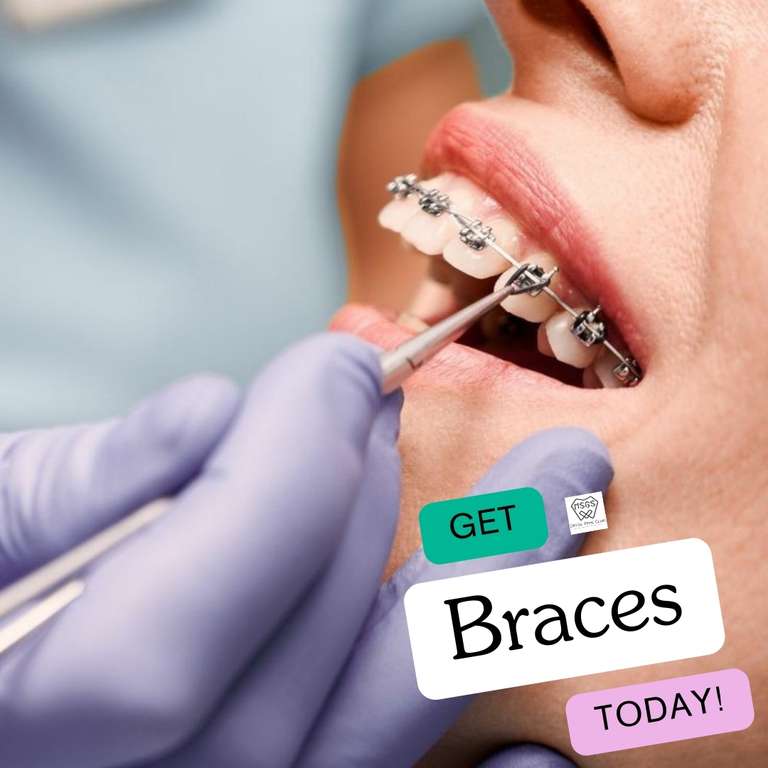 orthodontic treatment (braces)